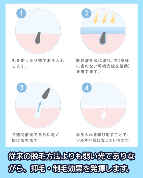 S.S.C.方式(Smooth Skin Control方式)の美容脱毛
