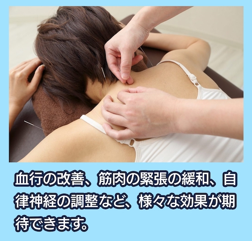 サルビア整骨院 鍼(はり)治療