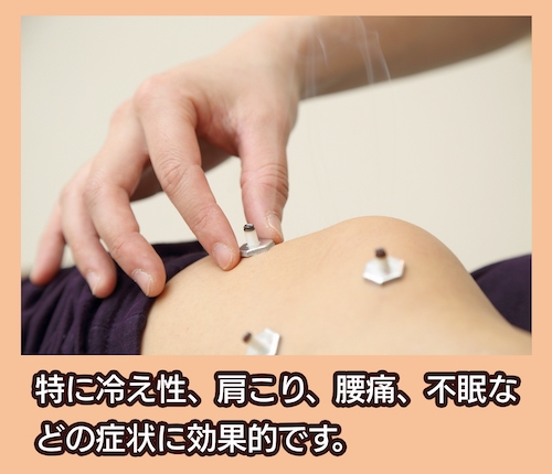 サルビア整骨院 灸(きゅう)治療